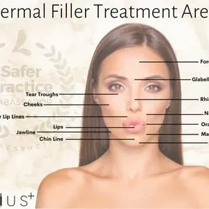 Dermal Filler Treatment Areas
